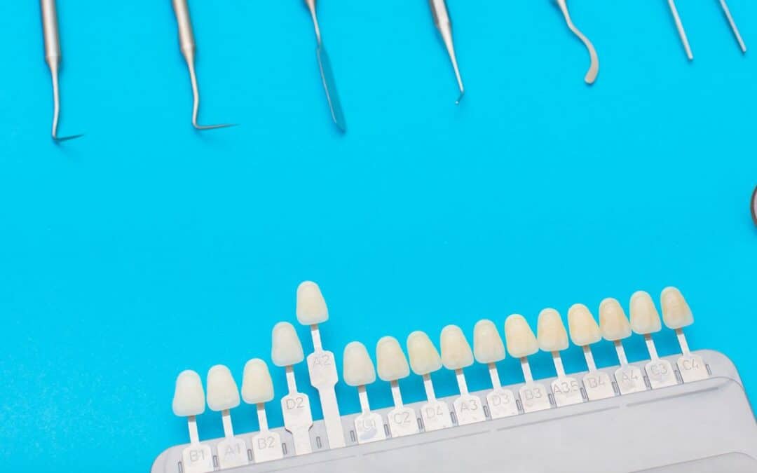 What Should You Know Before Getting Veneers?