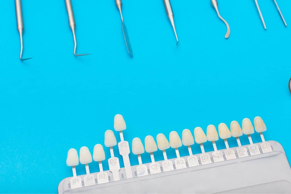 What Should You Know Before Getting Veneers cosmetic dentist sandy