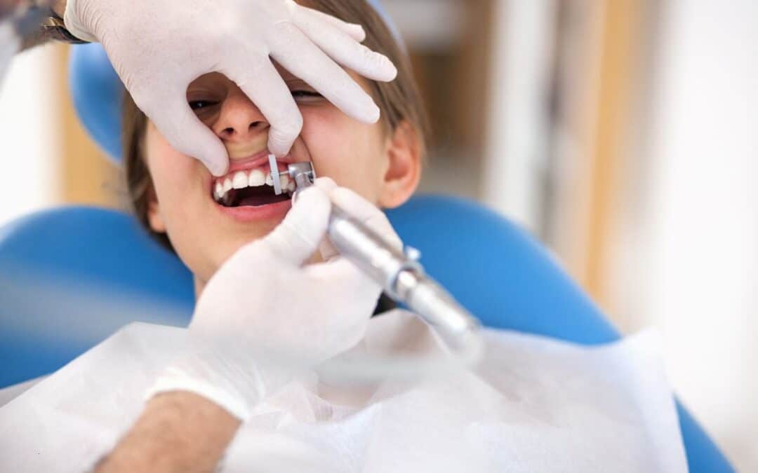 Do You Need a Dental Cleaning?