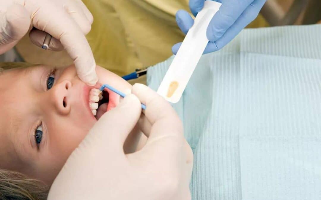 What is the Role of Fluoride in Dental Care?