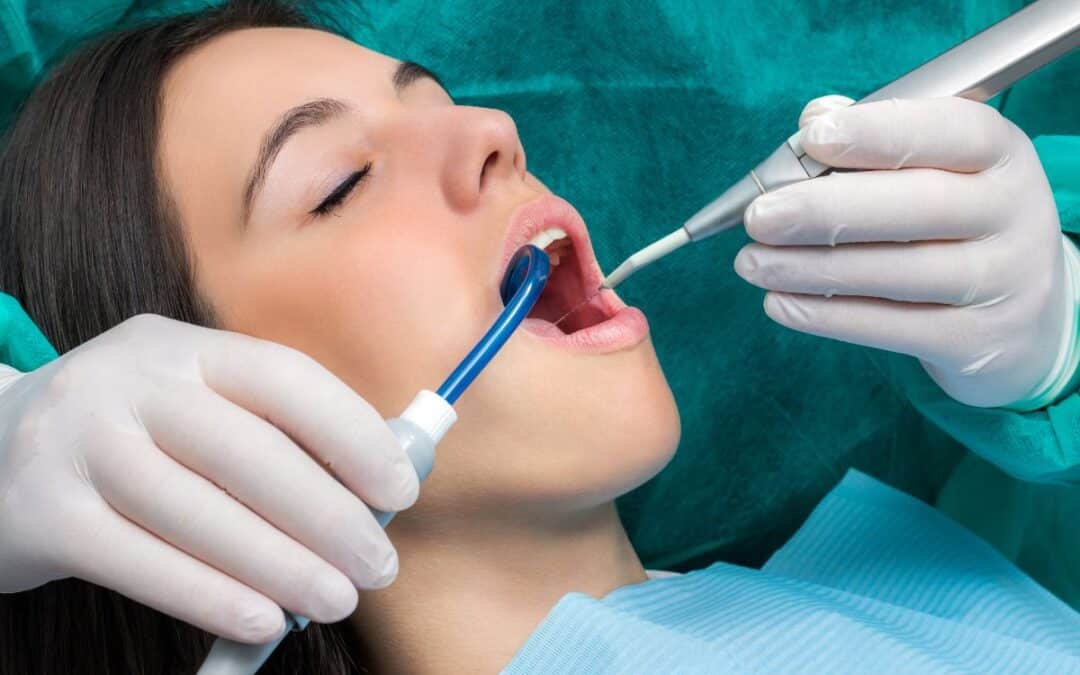 What Are The 4 Types Of Dental Cleanings?