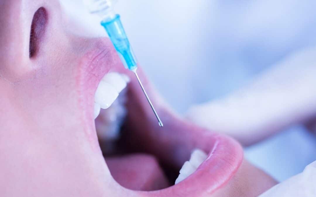 6 Reasons Why You Should Choose Sedation Dentistry