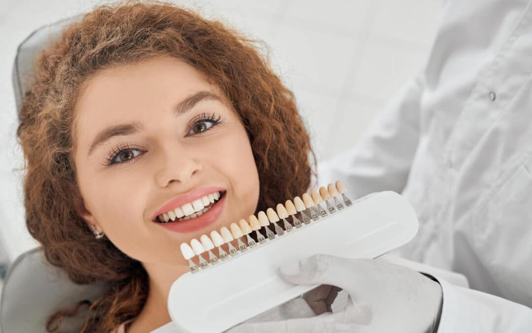 How Veneers Can Transform Discolored Teeth?