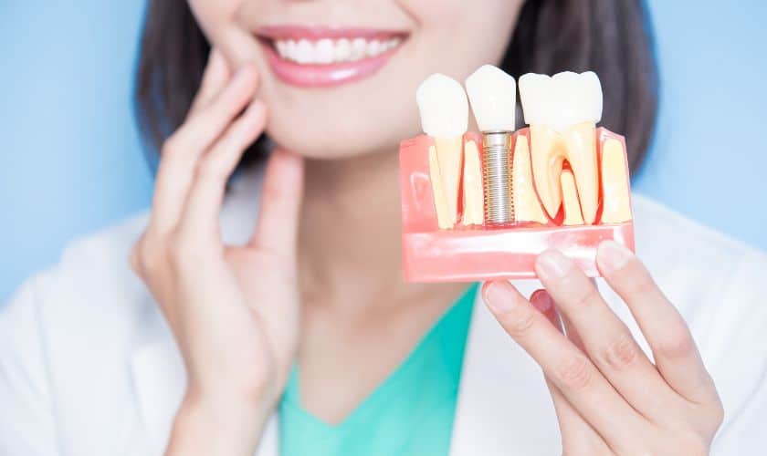 Frequently Asked Questions About Dental Implants in Sandy Dental Implants Sandy