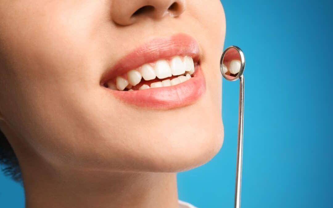 Can Cosmetic Bonding Help with Gaps Between Teeth?