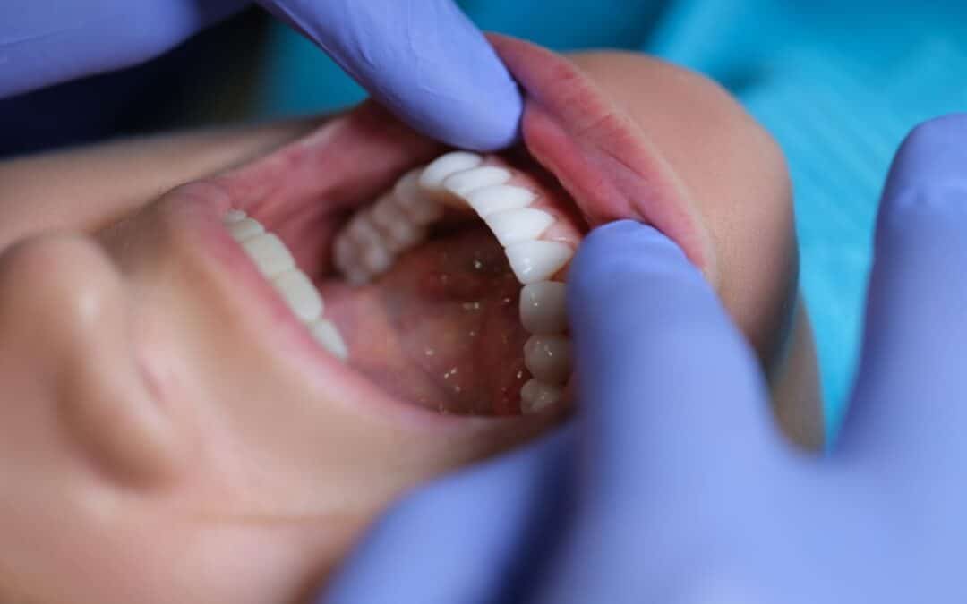 How Cosmetic Oral Surgery Can Transform Your Smile