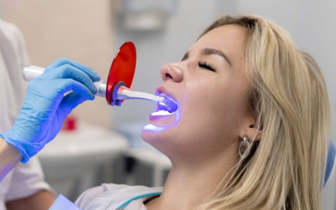 How Teeth Whitening Can Be the Perfect Confidence Boost in 2025?