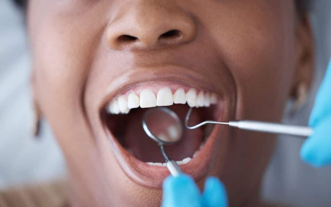 How a Dentist Can Help You Transition to Better Oral Health