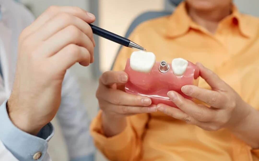 How to Find a Trusted Implant Dentist Near You—Fast!