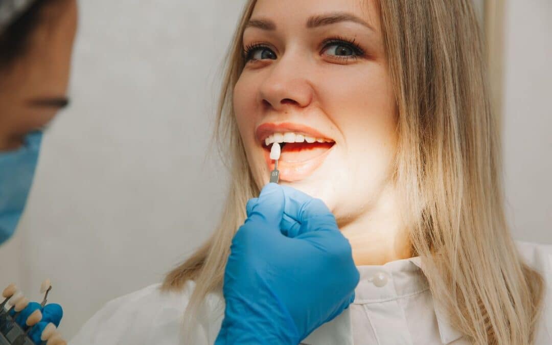 Can You Get Cavities Under Veneers?