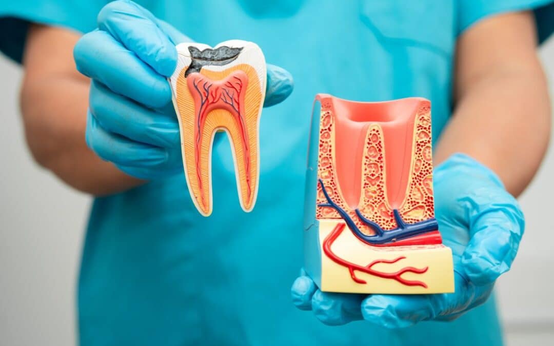 What to Know Before & After Getting a Root Canal