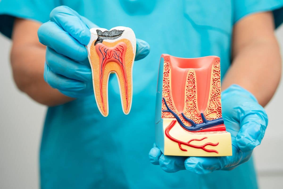 Root Canal Therapy in Sandy