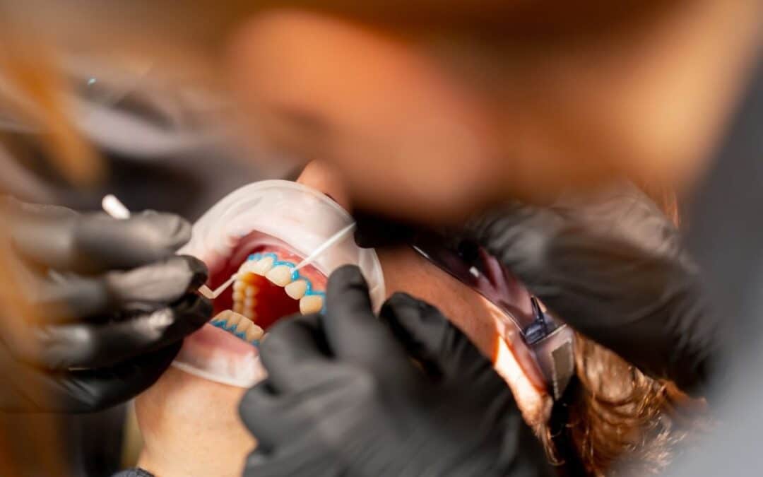 Thinking About Cosmetic Dentistry in Sandy? Here’s What You Need to Know First