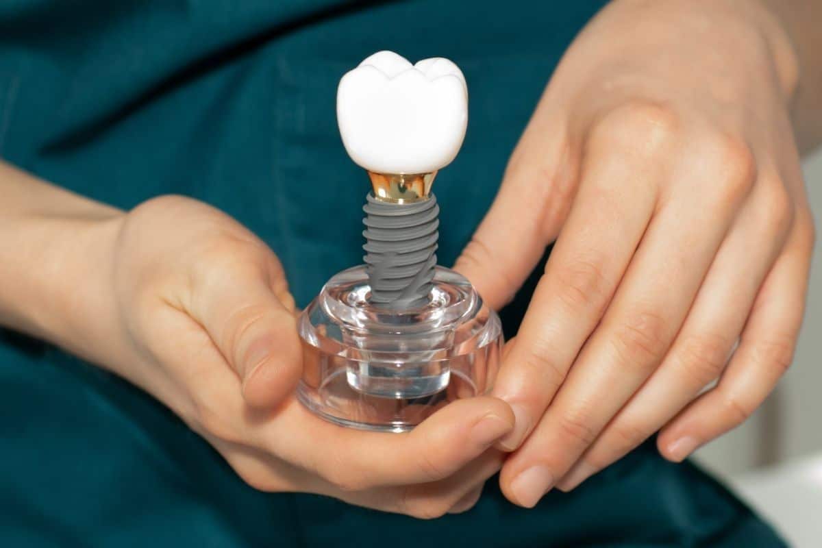 dental implants modul in hand dental implants module in hand