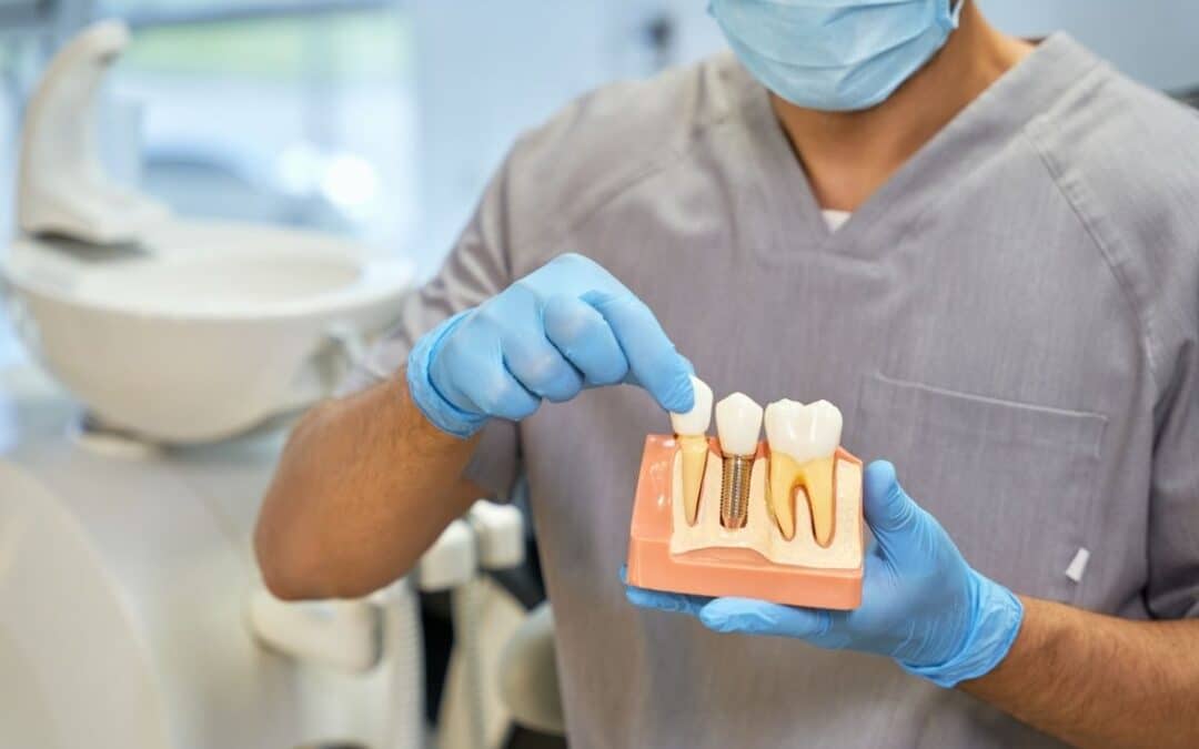 Is It Better to Get a Root Canal or a Dental Implant? A Complete Guide