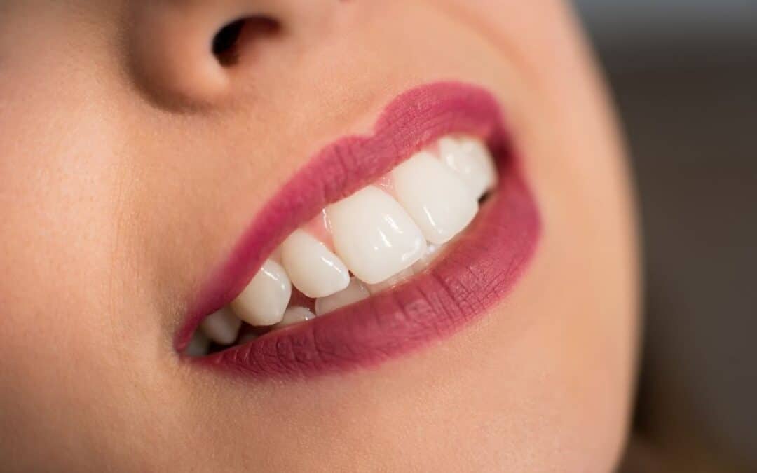 Are Clear Aligners Considered Cosmetic Dentistry?