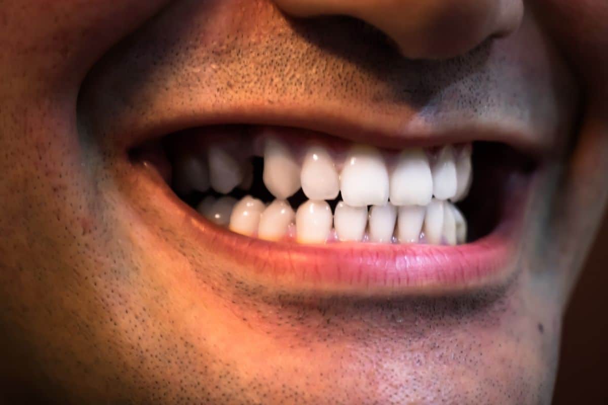closeup-shot-of-a-male-open-mouth-showing-white-teeth