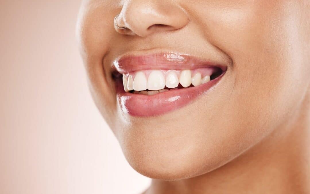 Teeth Whitening or Cosmetic Bonding: Which Treatment Do You Need?