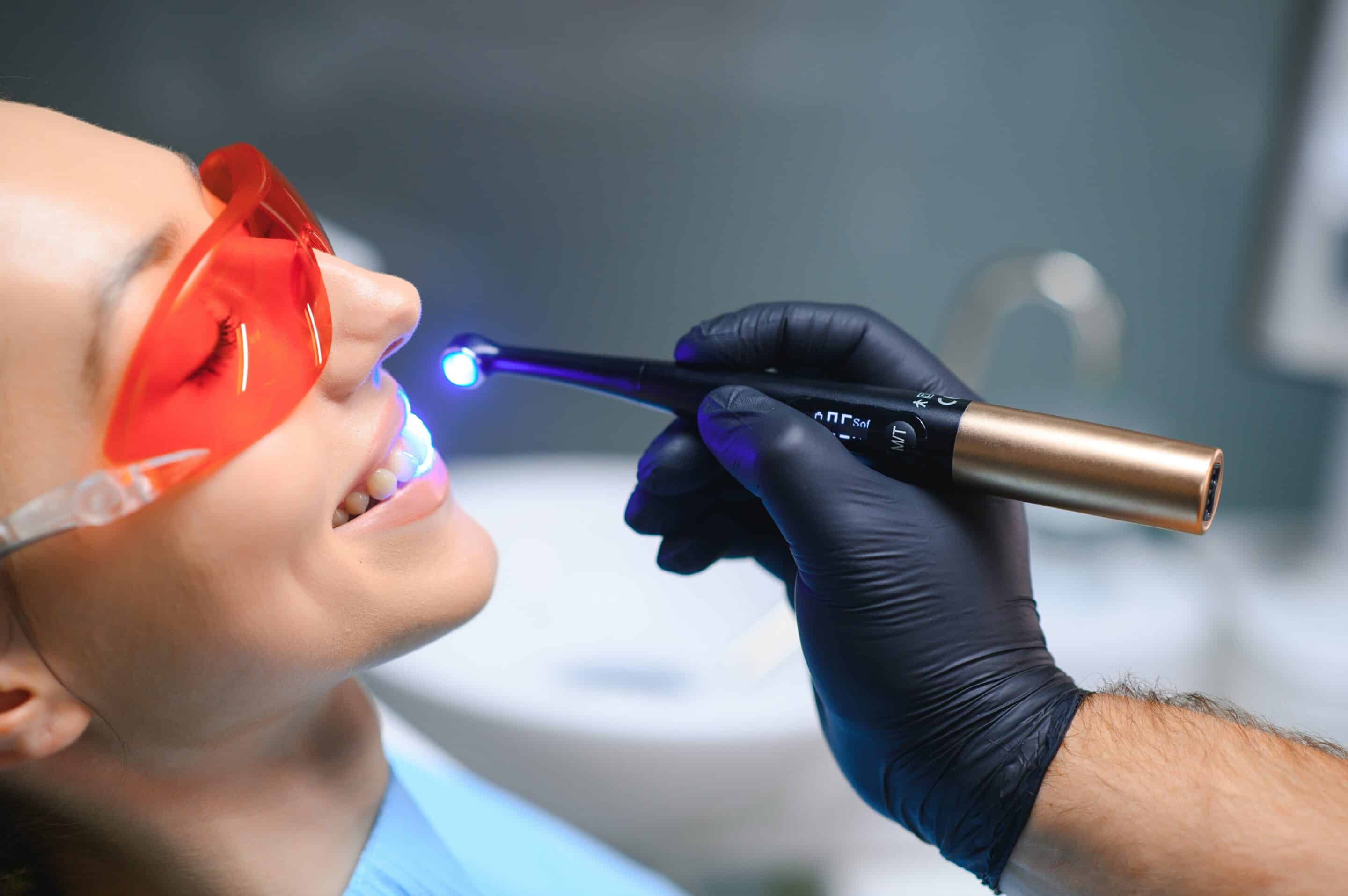 Teeth Whitening in Sandy Your Teeth Whitening Results Might Disappoint You